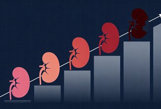 一年痛风发作几次最危险？3万人7年追踪：发作≥5次肾病风险飙升46%