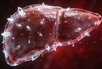 痛风直接伤肝！UK Biobank 2万人MRI：即使不胖转氨酶正常肝也在纤维化