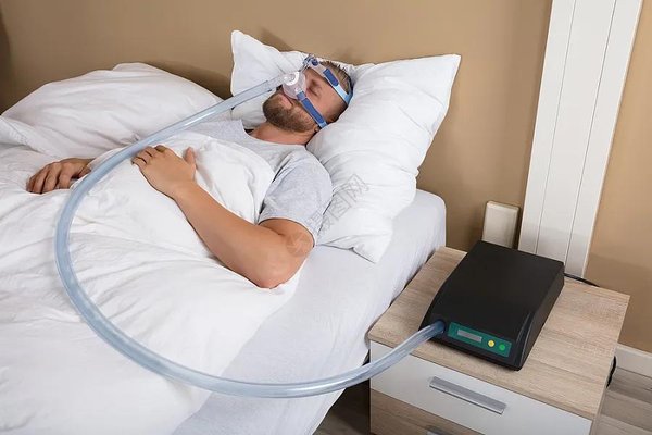 睡眠呼吸暂停患者使用CPAP呼吸机治疗